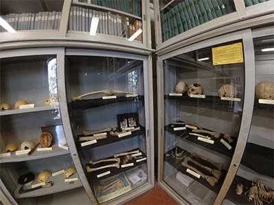 Pisa Museo di Anatomia Patologica